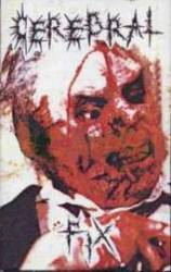 Cerebral Fix : We Need Therapy